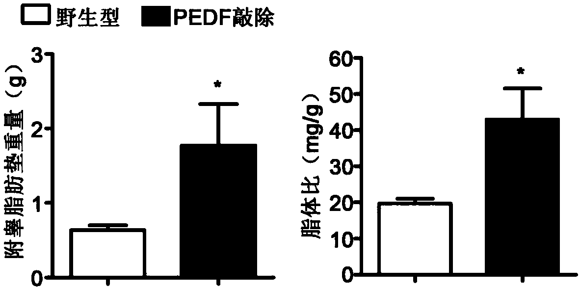 Application of PEDF gene in treating diabetic myocardial damage