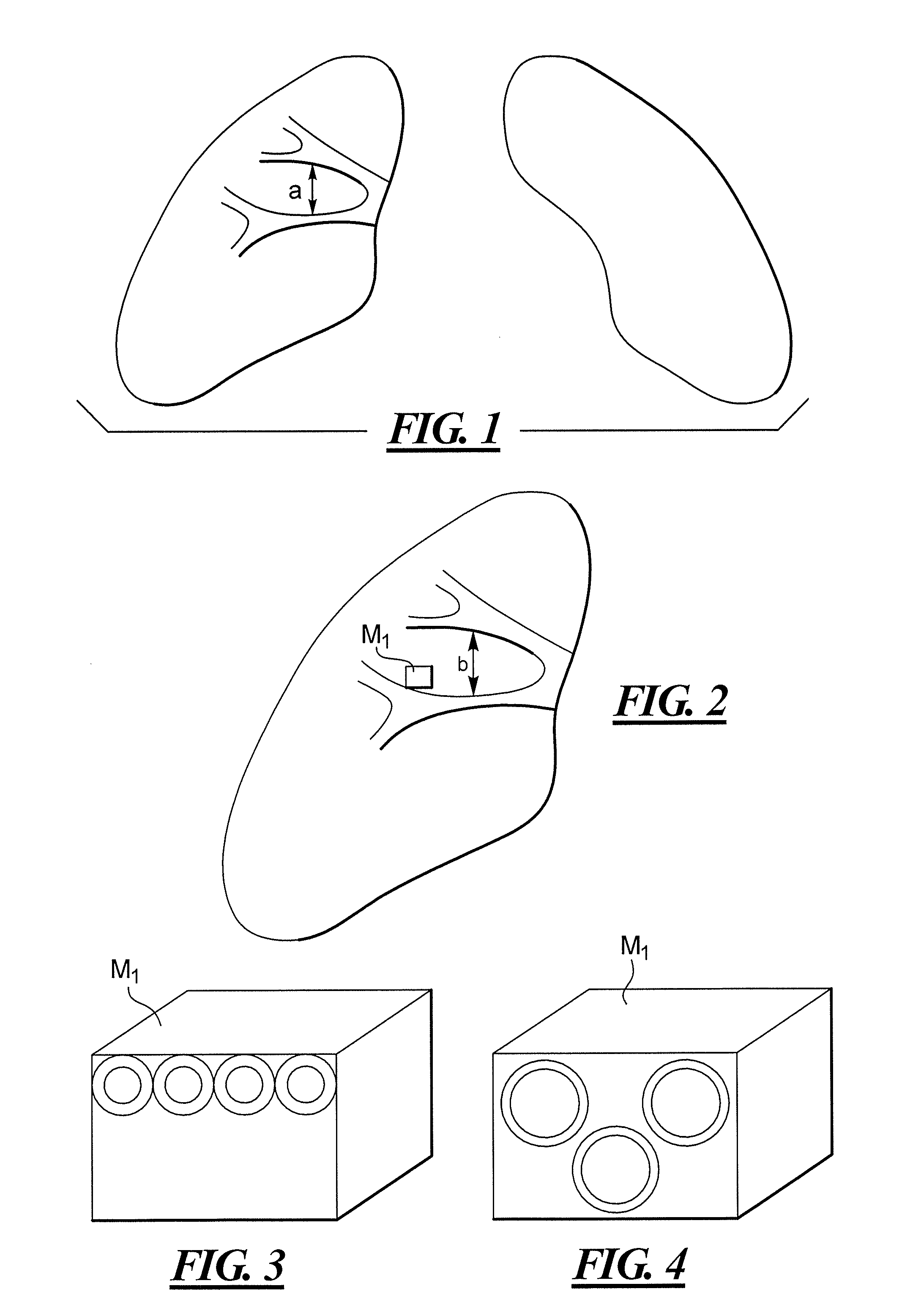Method for diagnosis of functional lung illnesses