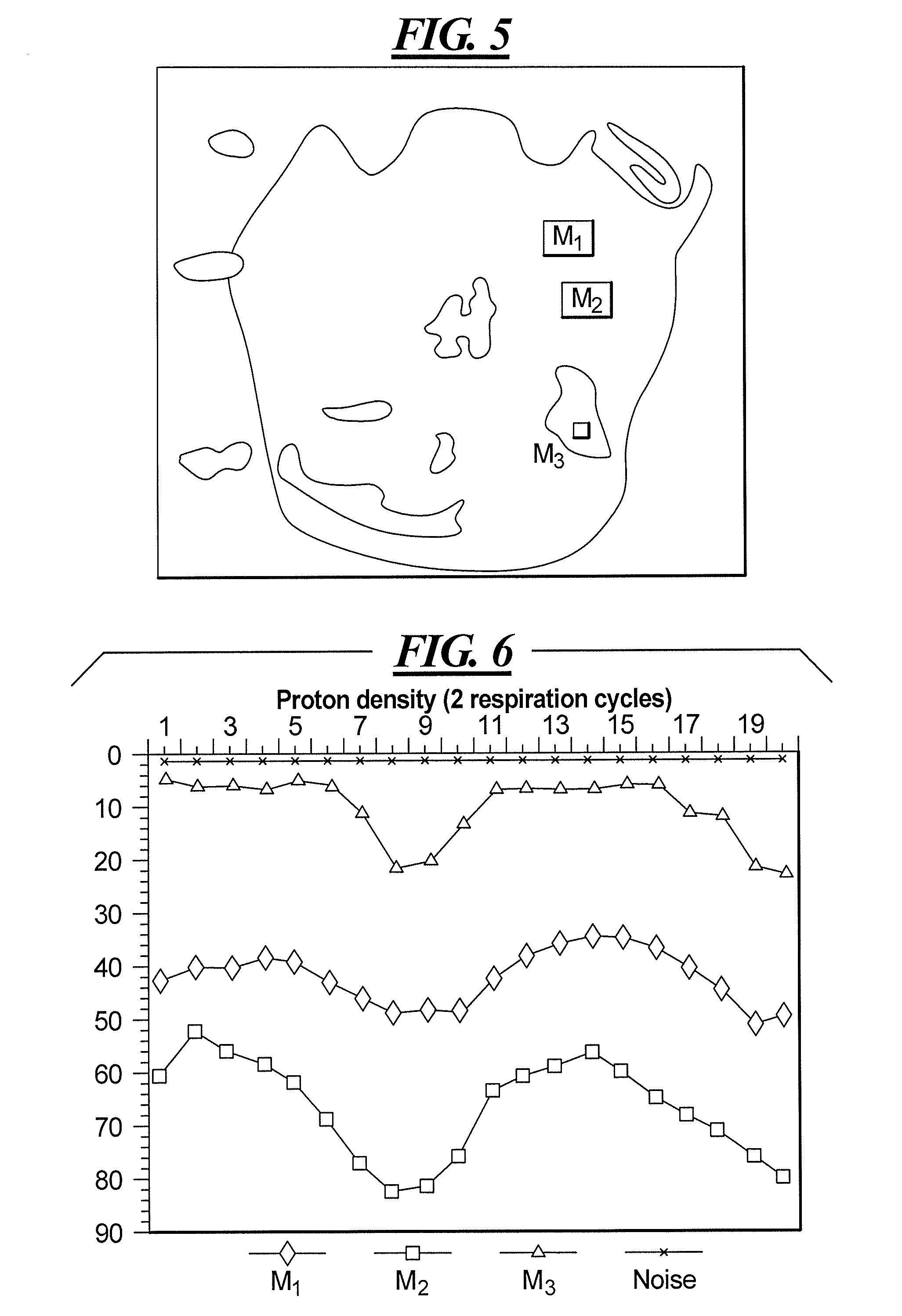 Method for diagnosis of functional lung illnesses