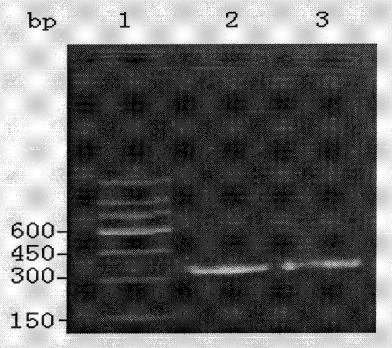 Chronic myeloid leukemia DNA vaccine BCR/ABL-pIRES-SEA and preparation method and application thereof