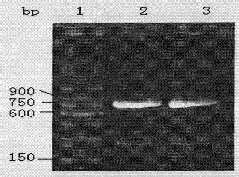 Chronic myeloid leukemia DNA vaccine BCR/ABL-pIRES-SEA and preparation method and application thereof