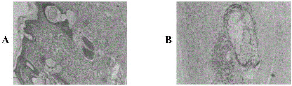 A kind of medical suture and preparation method thereof