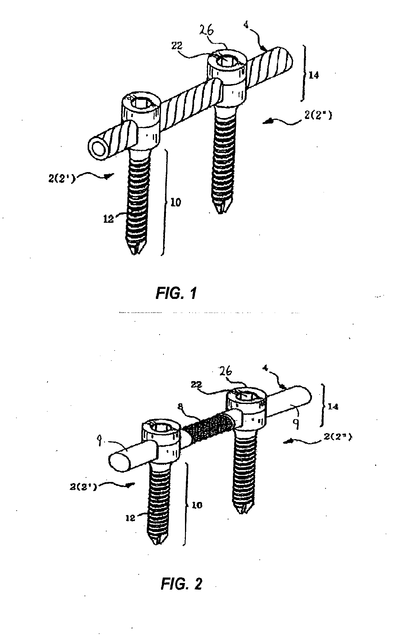 Spinal Stabilization Device