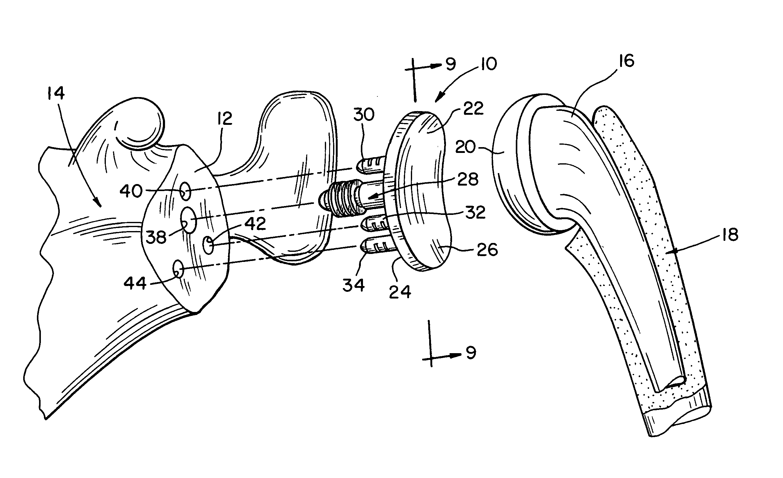 Method for securing a glenoid component to a scapula