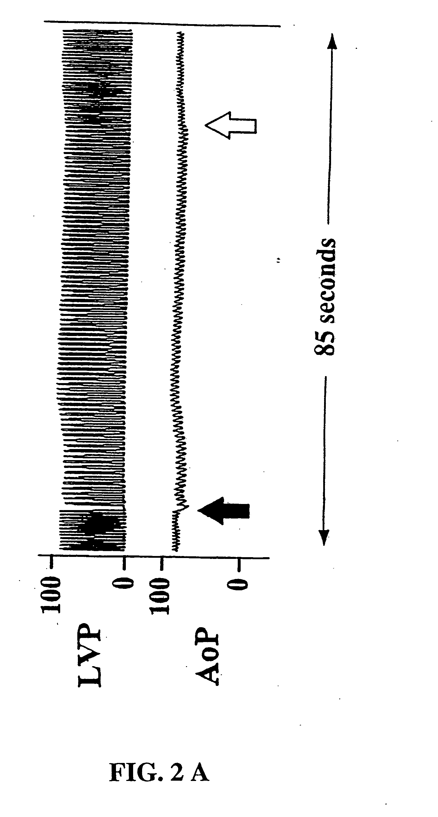 Methods of indirectly stimulating the vagus nerve with an electrical field