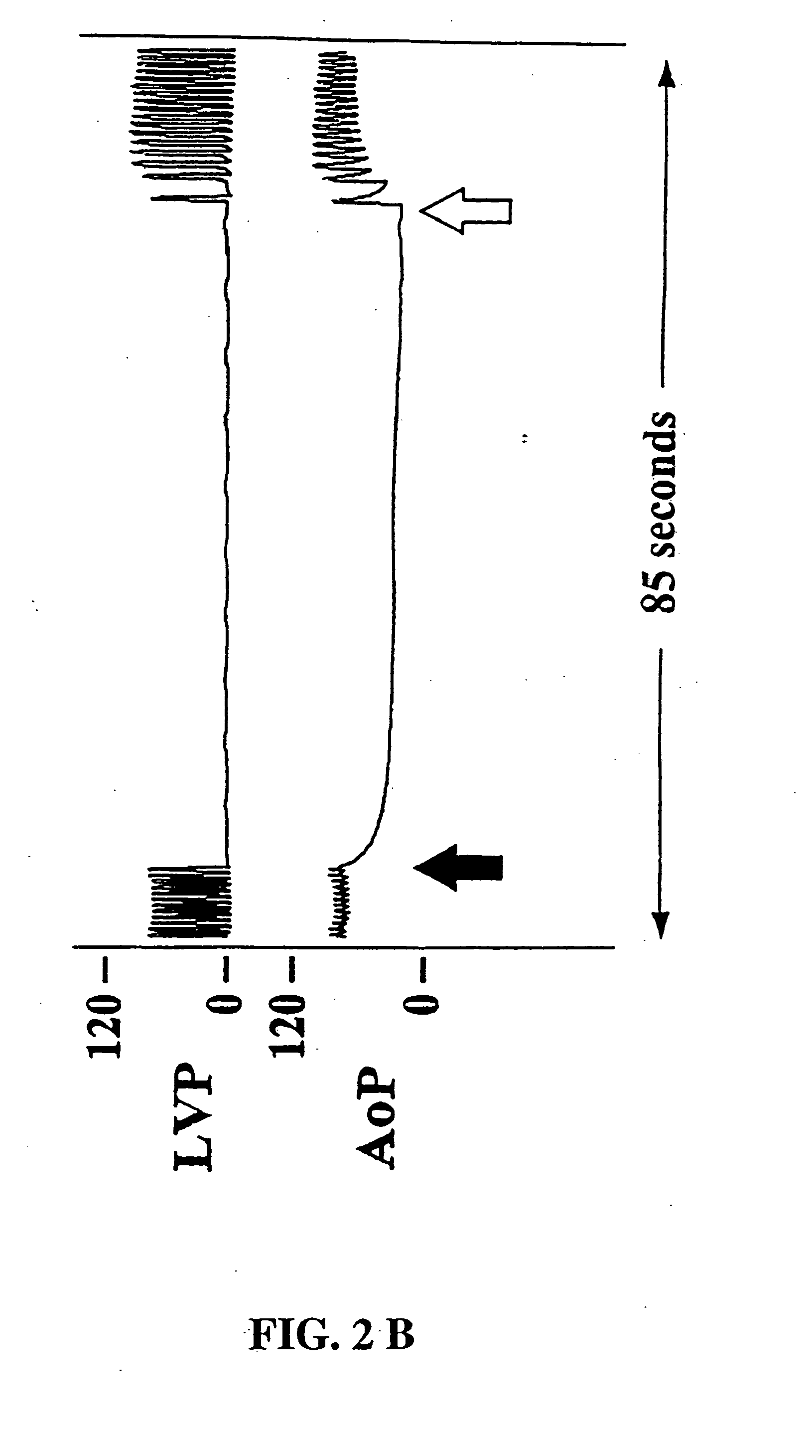 Methods of indirectly stimulating the vagus nerve with an electrical field