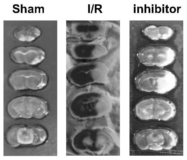 Application of compound EPZ5676 and related inhibitor thereof in preparation of medicines for resisting cerebral ischemia diseases