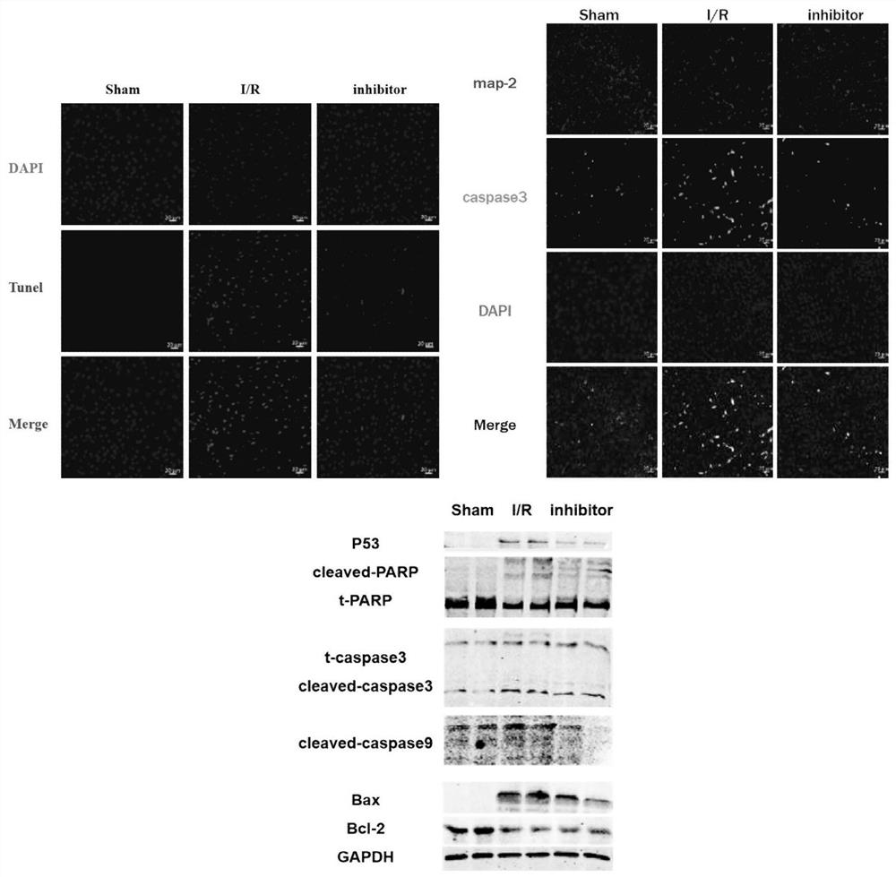 Application of compound EPZ5676 and related inhibitor thereof in preparation of medicines for resisting cerebral ischemia diseases