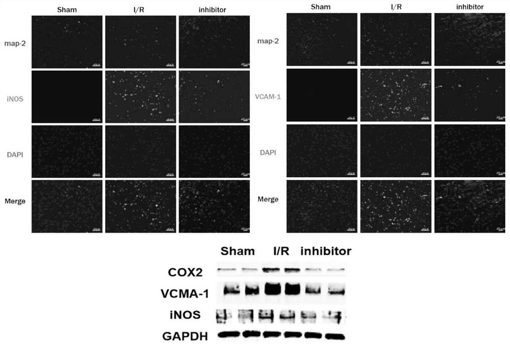 Application of compound EPZ5676 and related inhibitor thereof in preparation of medicines for resisting cerebral ischemia diseases