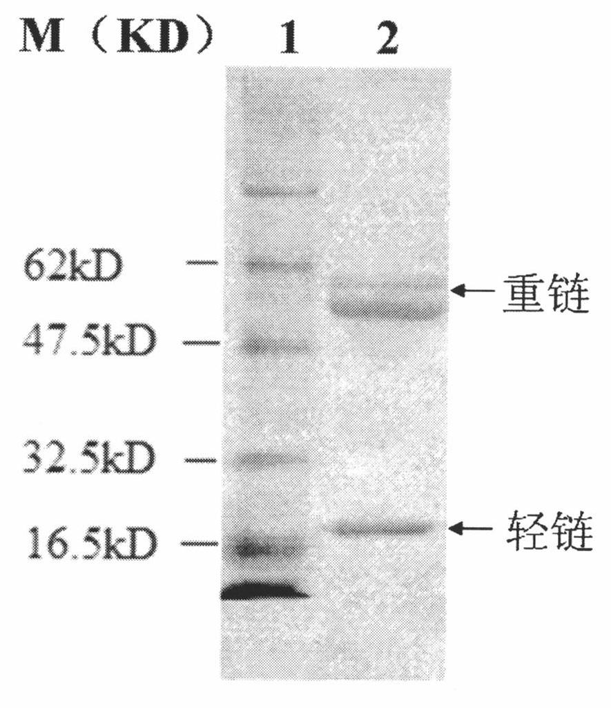 Heavy and light chain variable region gene of monoclonal antibody resisting human amyloid protein, and its uses