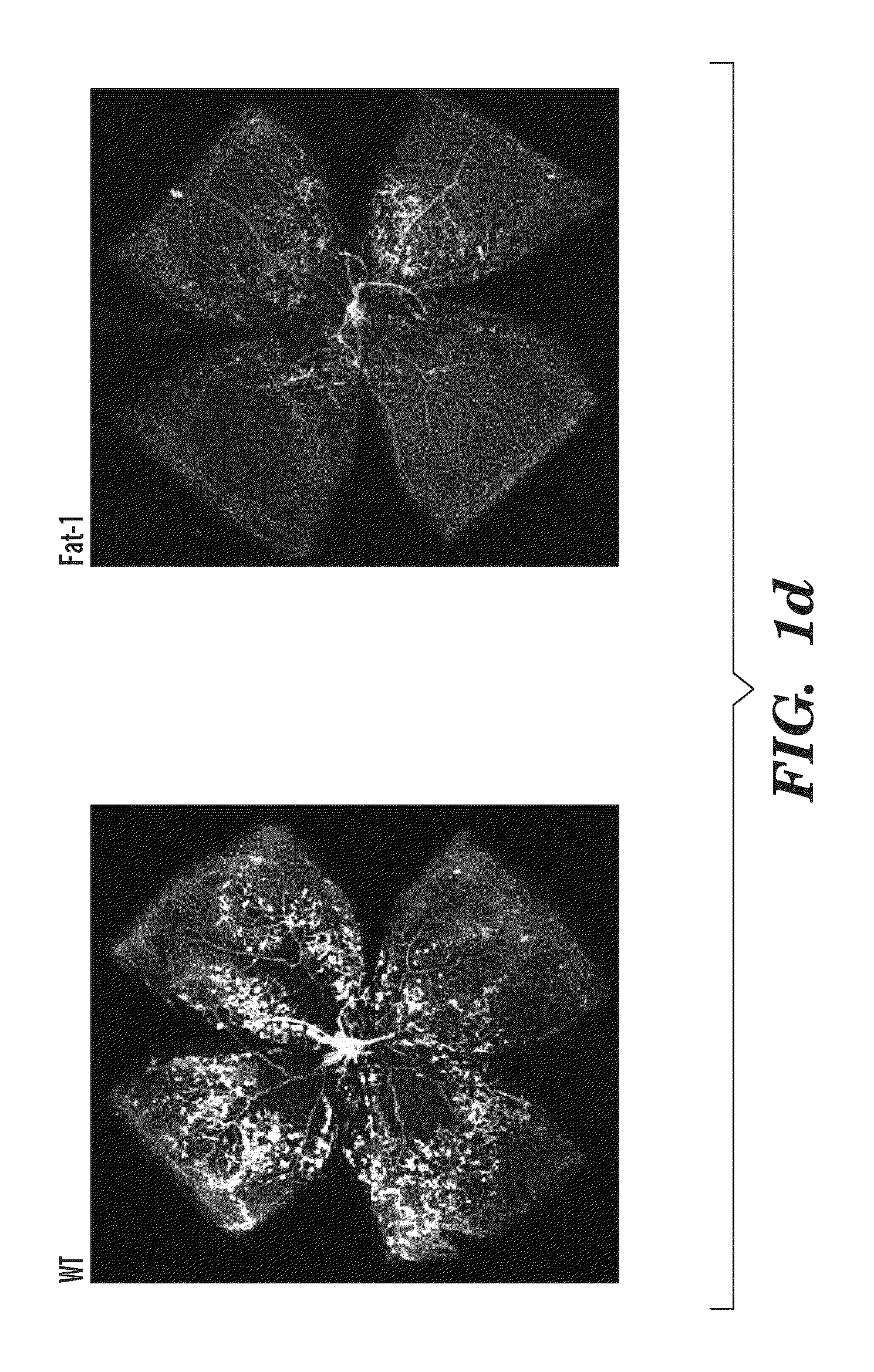 Use of resolvins and docosatrienes and analogues thereof for the treatment of angiogenesis and ocular neovascularization