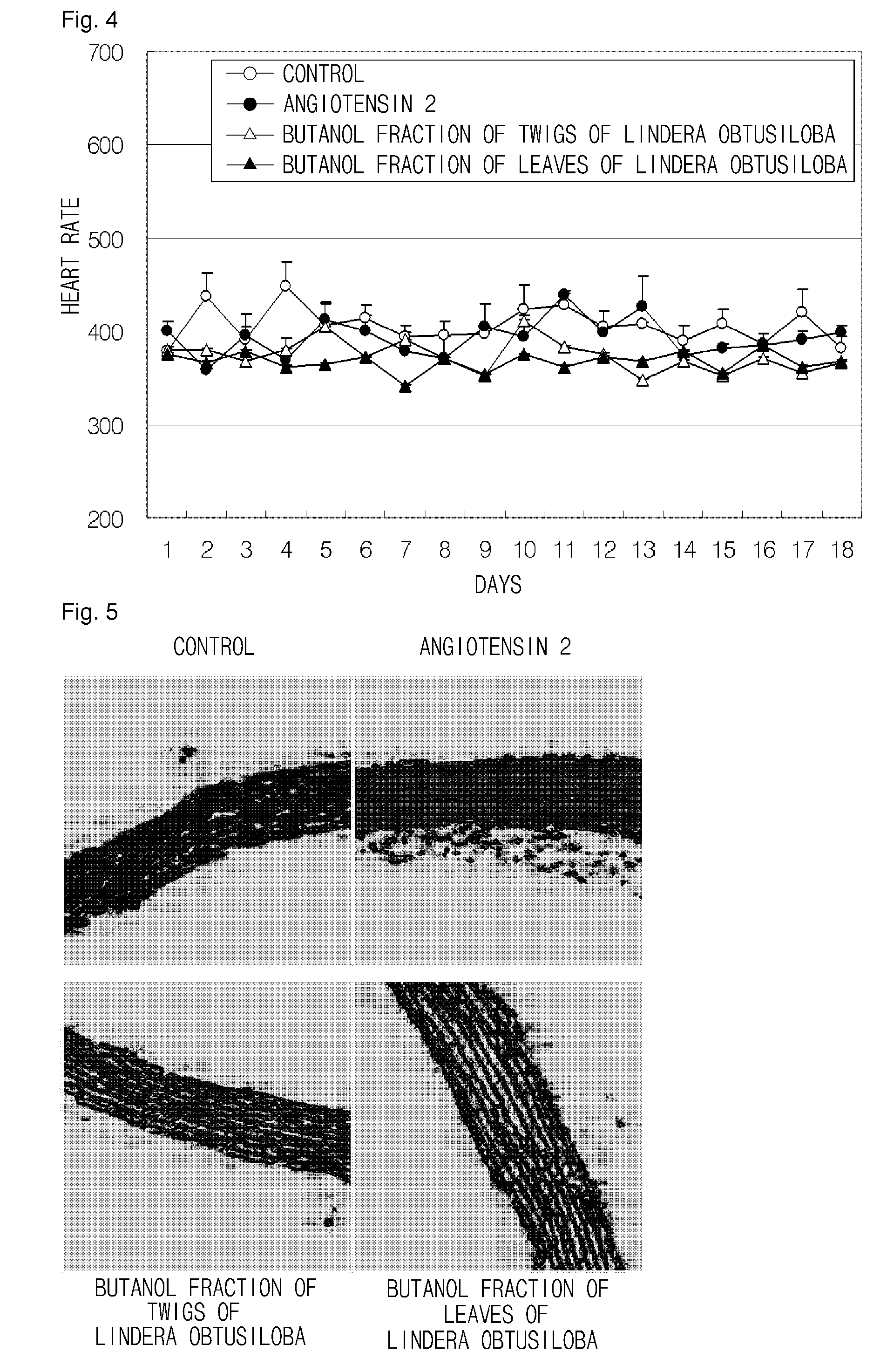 Composition comprising the extracts of lindera obtusiloba for prevention and treatment of cardiovascular diseases