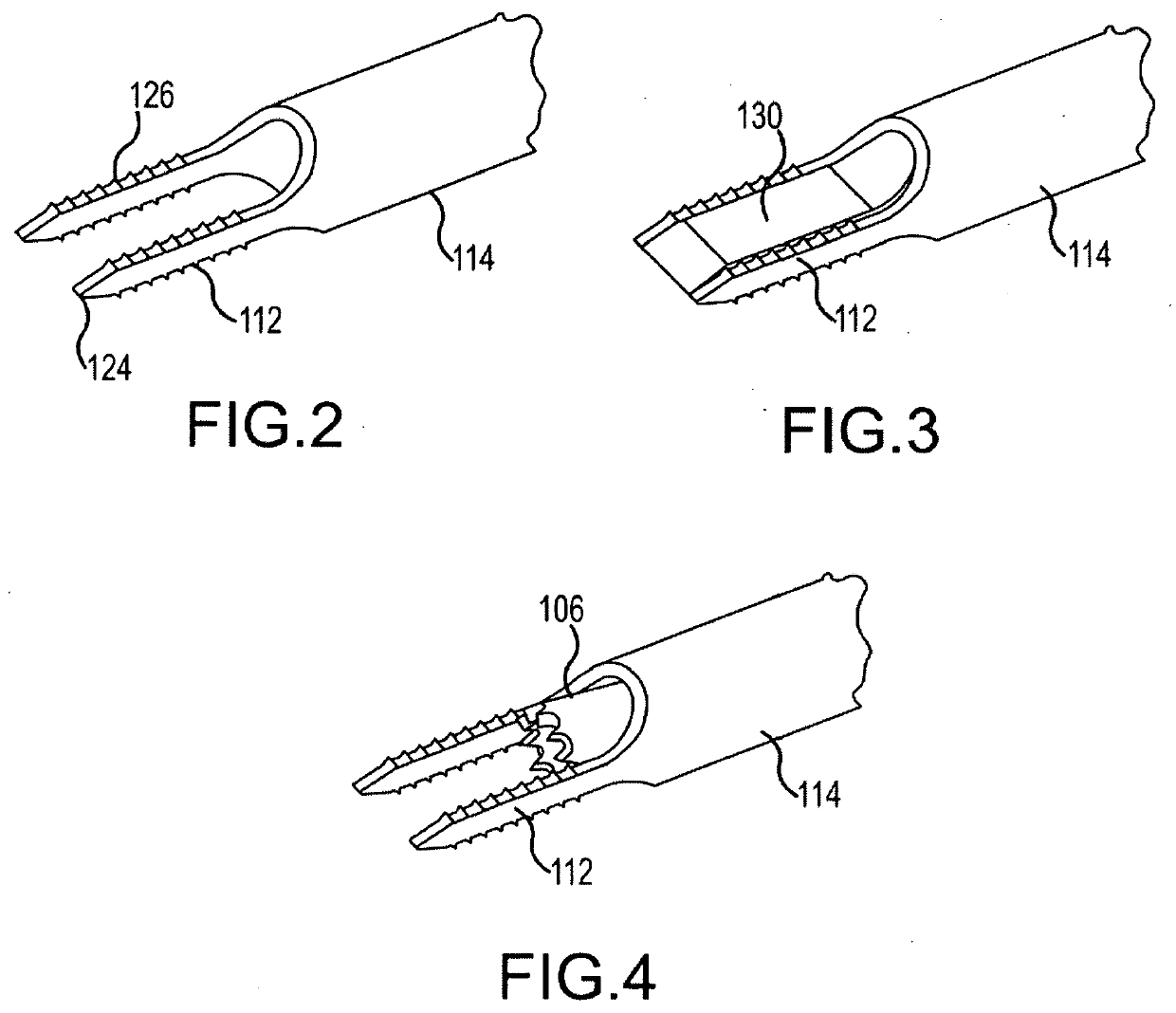 Vertebral joint implants and delivery tools