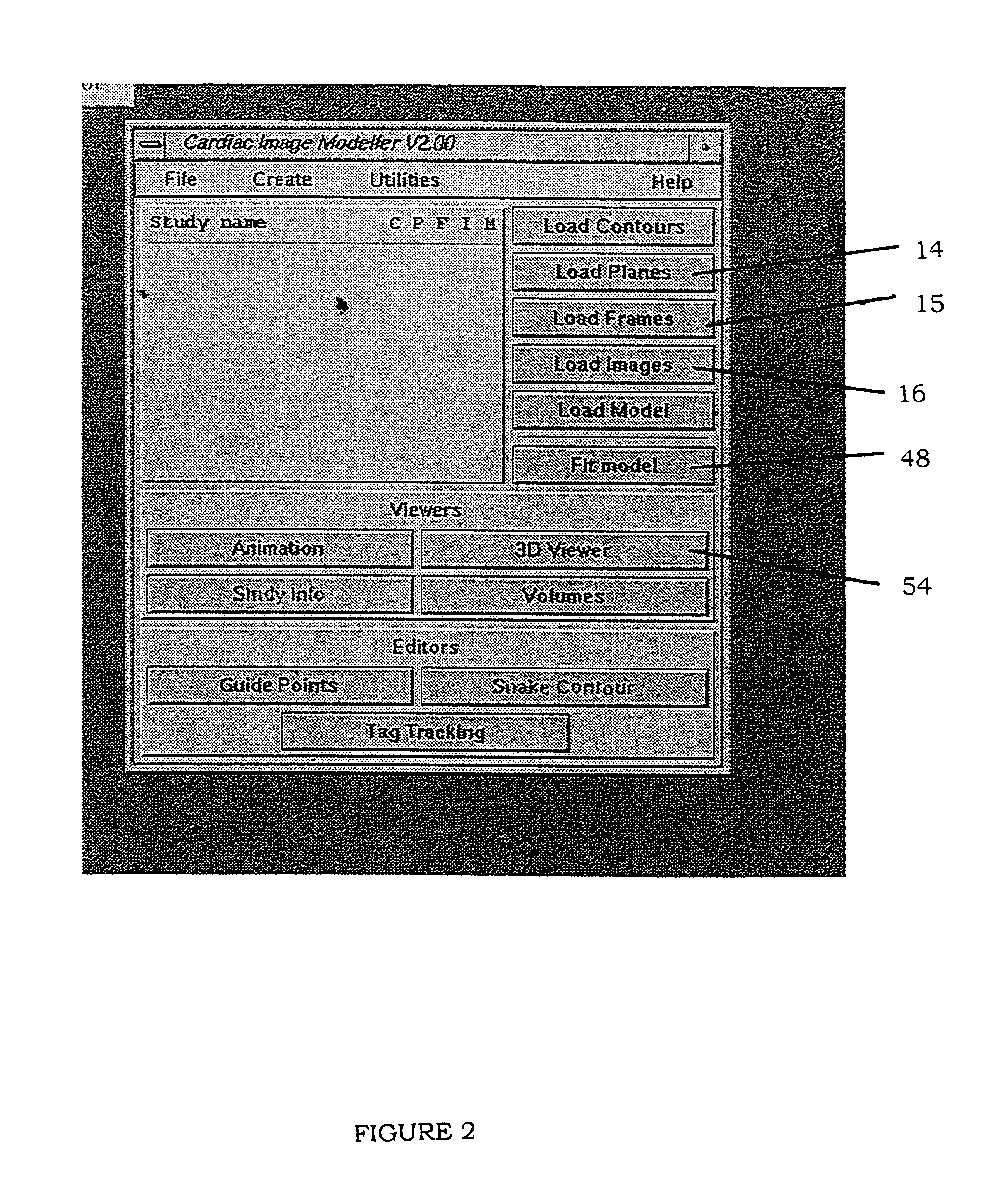 Method and system of measuring characteristics of an organ