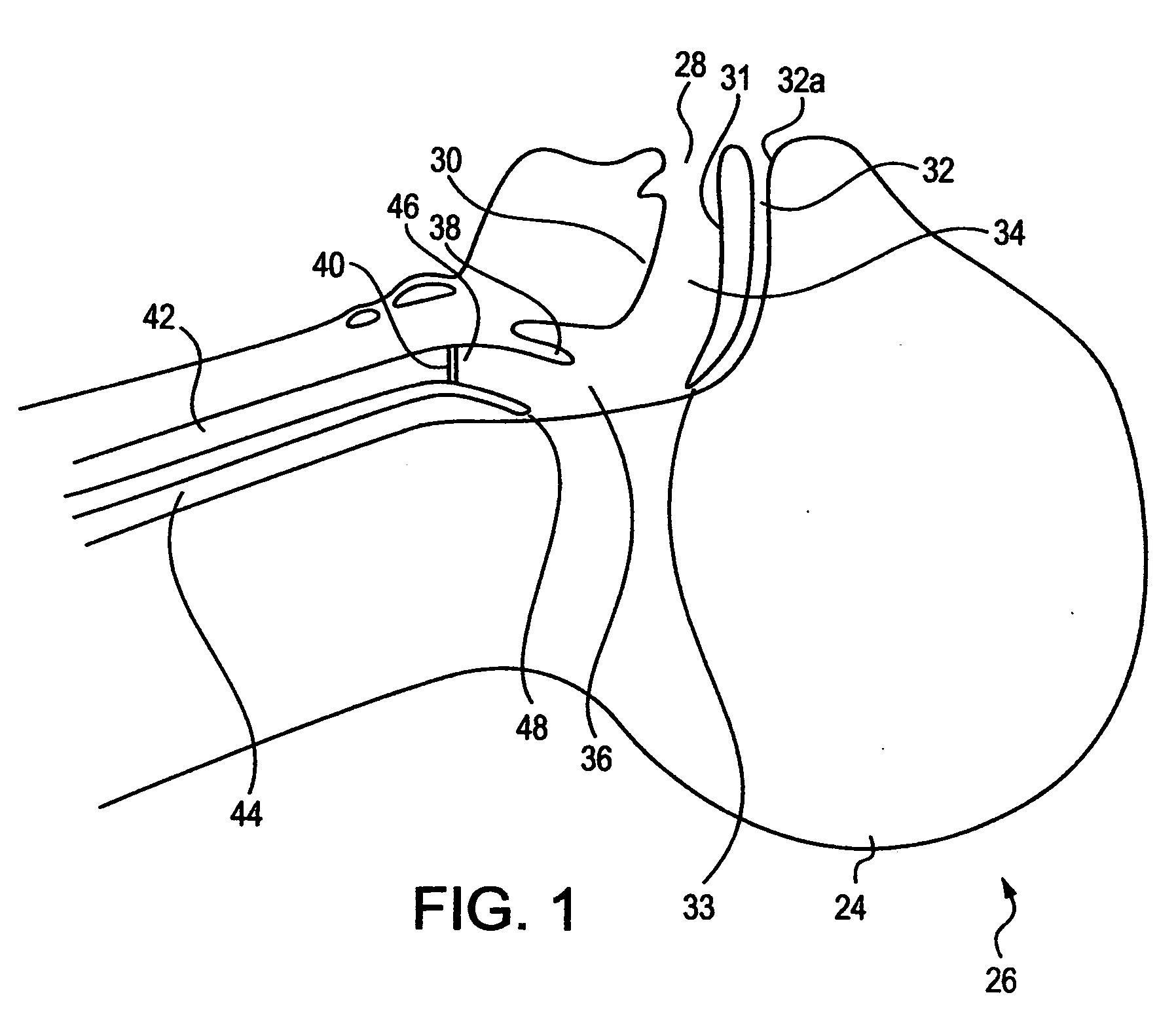 Airway device and methods of making and use thereof