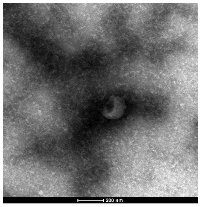 Detection reagent of biomarker for early diagnosis of pancreatic cancer