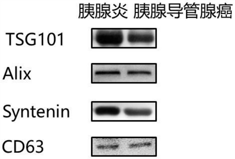 Detection reagent of biomarker for early diagnosis of pancreatic cancer