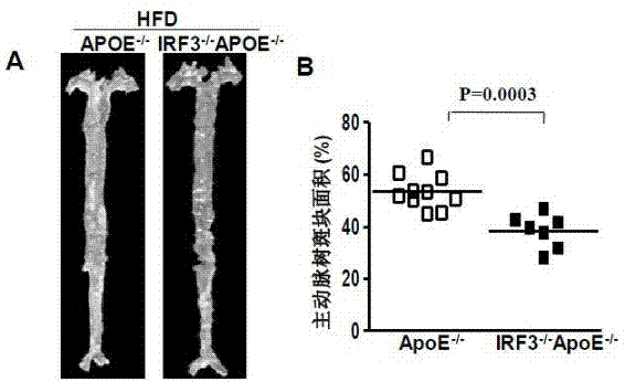 Function of IRF (Interferon Regulatory Factor) 3 gene in atherosclerosis and application of inhibitor of IRF3 gene