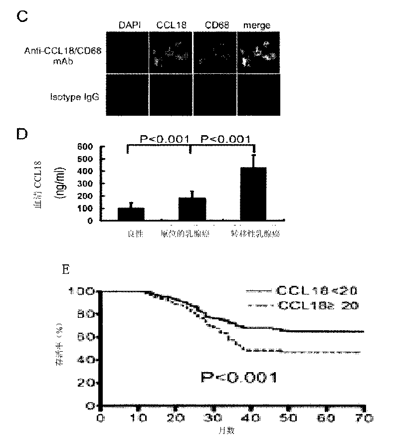 Method for restraining infiltration and metastasis of breast cancer cells by using target CCL 18 and application thereof
