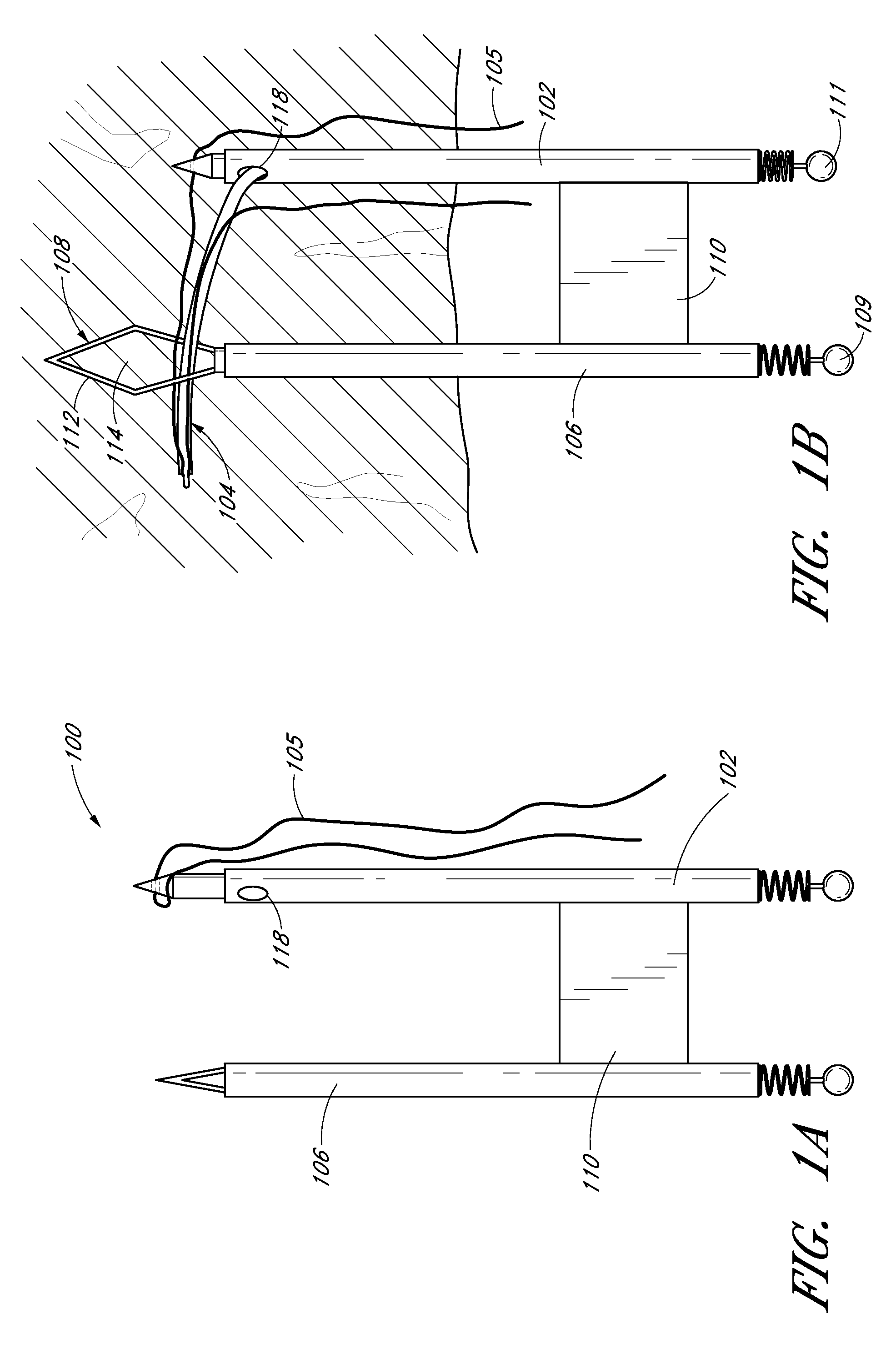 Suture passer systems and methods for tongue or other tissue suspension and compression