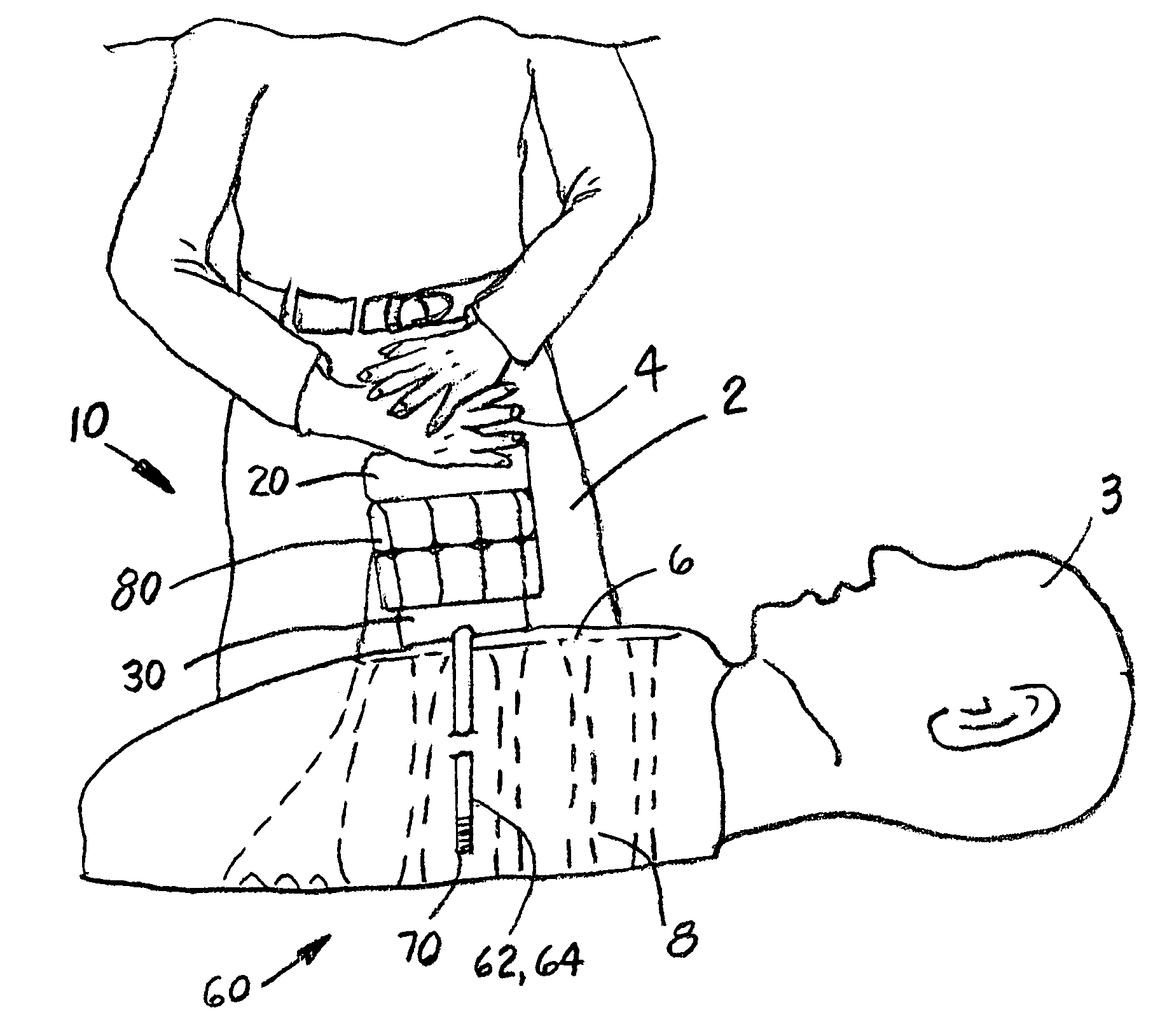 Device and kit for assisting in cardiopulmonary resuscitations