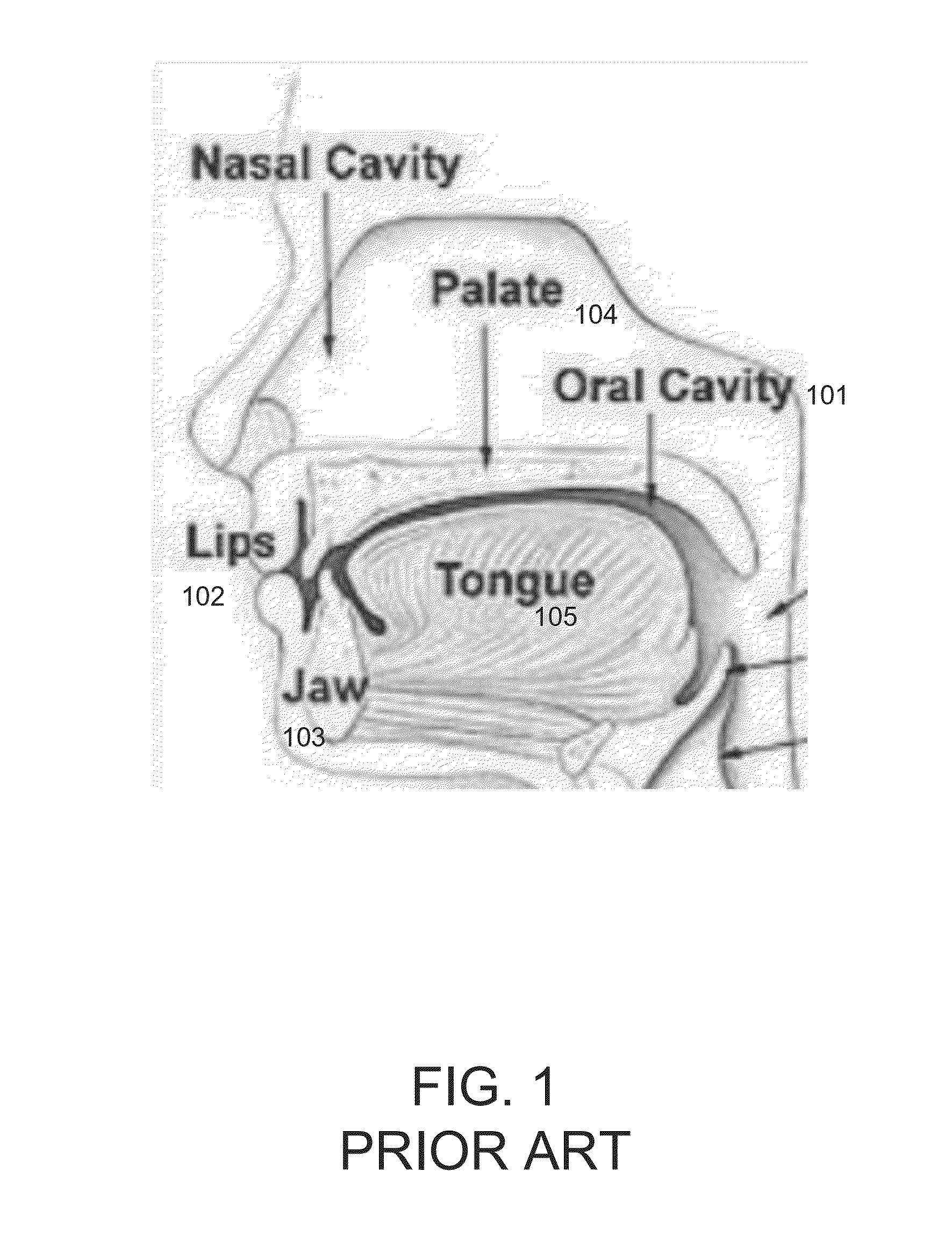 Oral anesthesia application