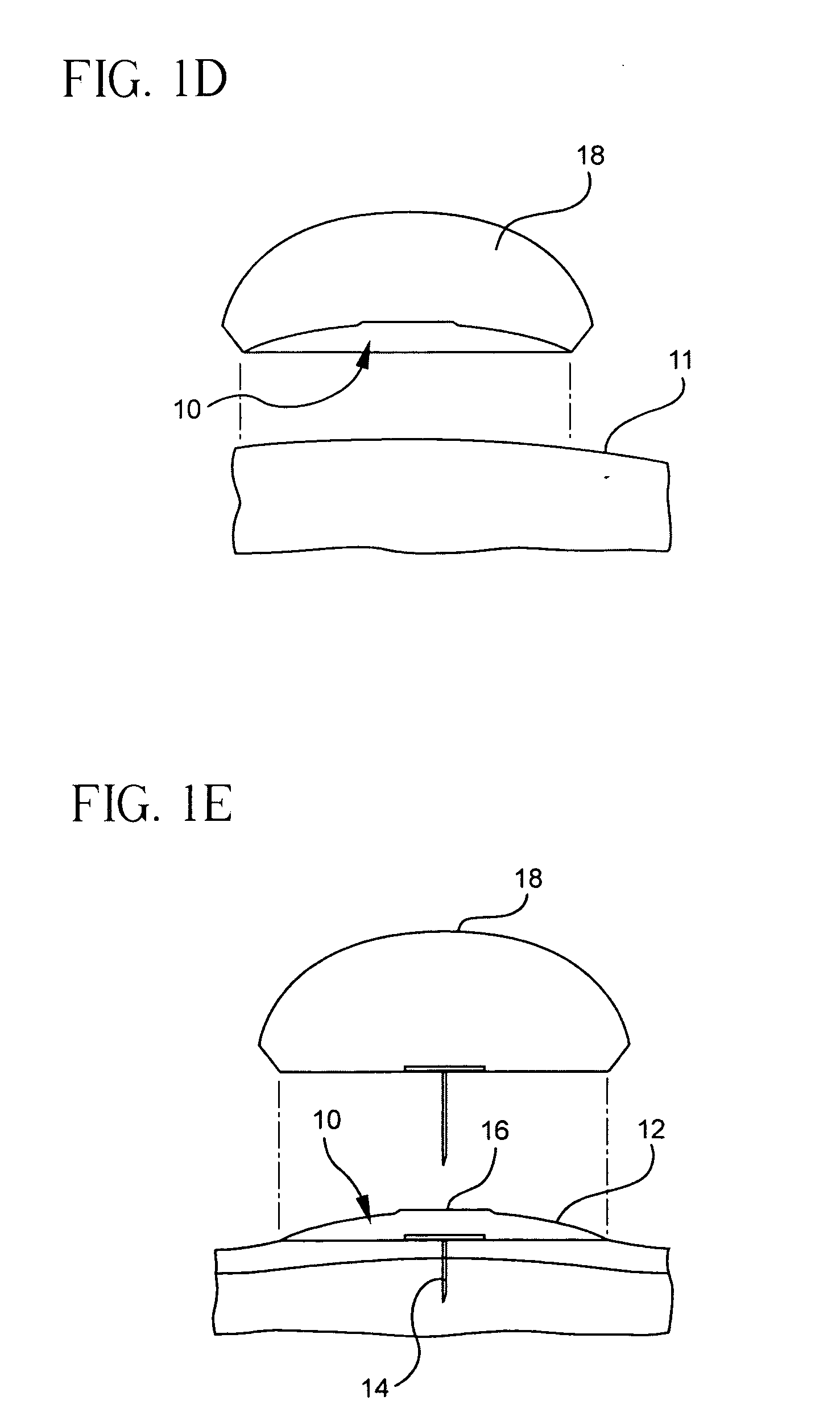 Method and apparatus for delivering a therapeutic substance through an injection port