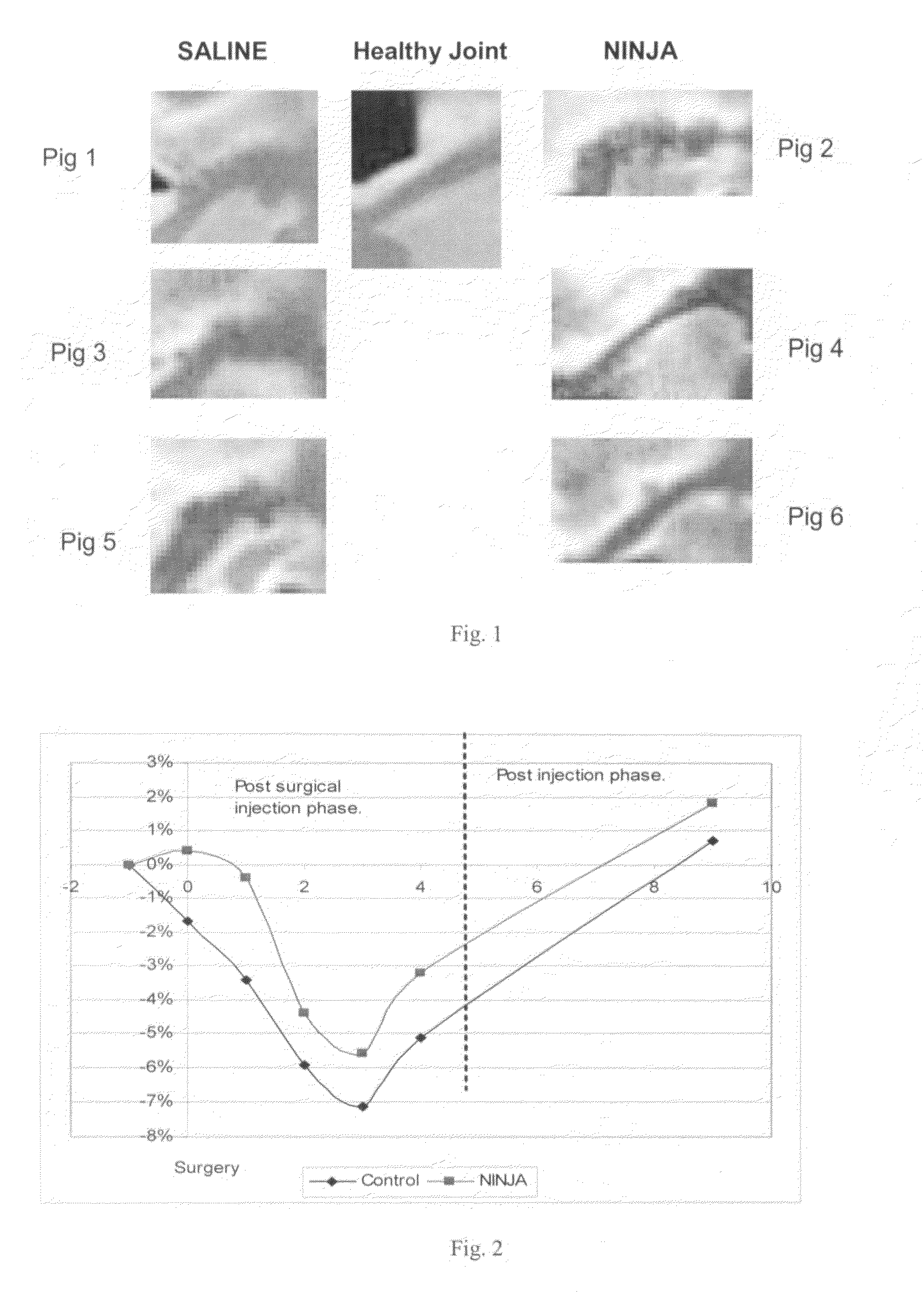 Polymer gel containing hyaluronic acid and collagen, and its use in joints