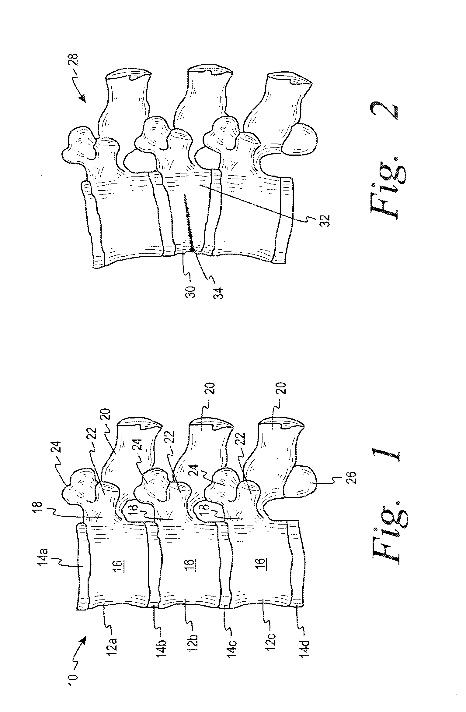Devices and methods for treating bone tissue