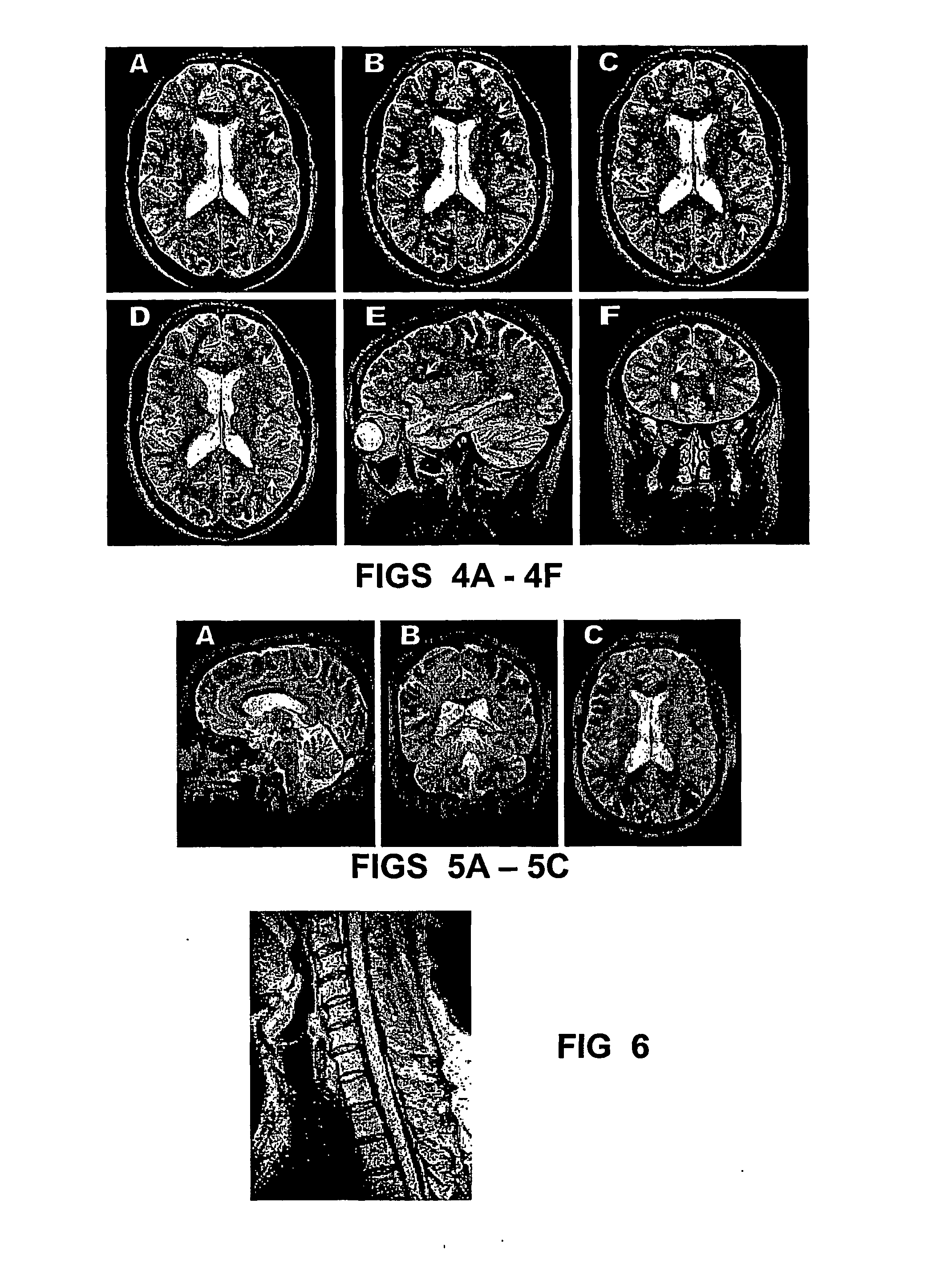 Method and apparatus for spin-echo-train MR imaging using prescribed signal evolutions