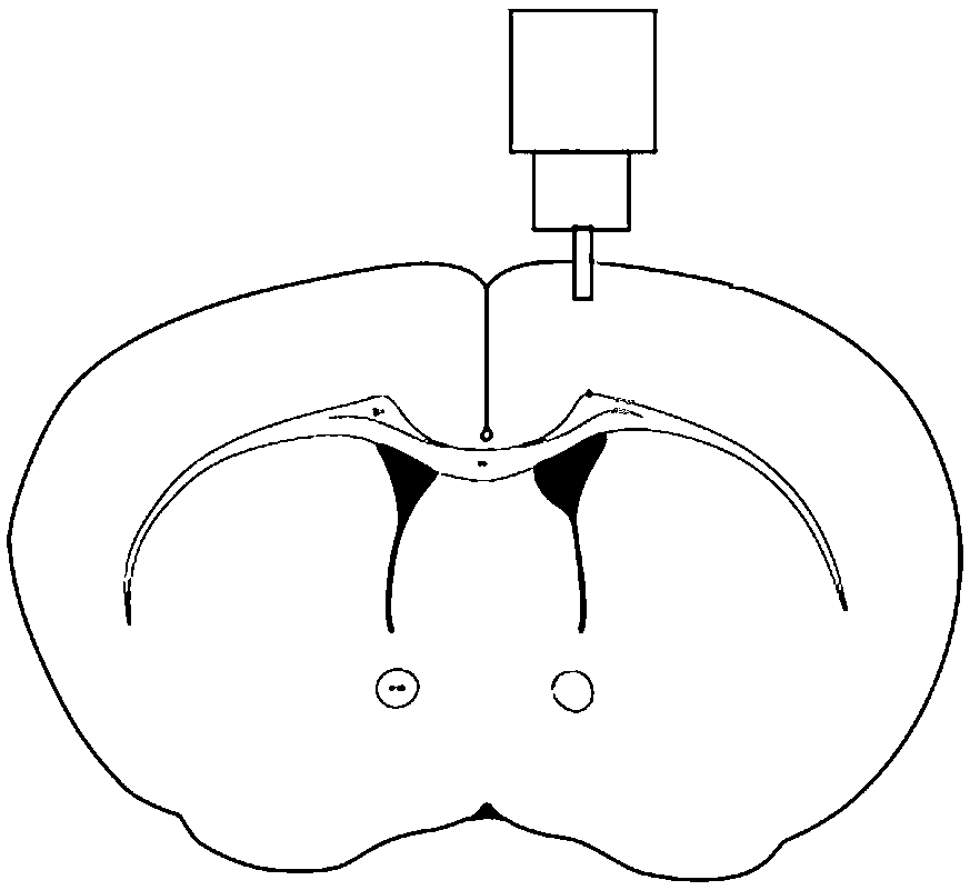 Application of L-serine to prevention or treatment of high-altitude craniocerebral injury