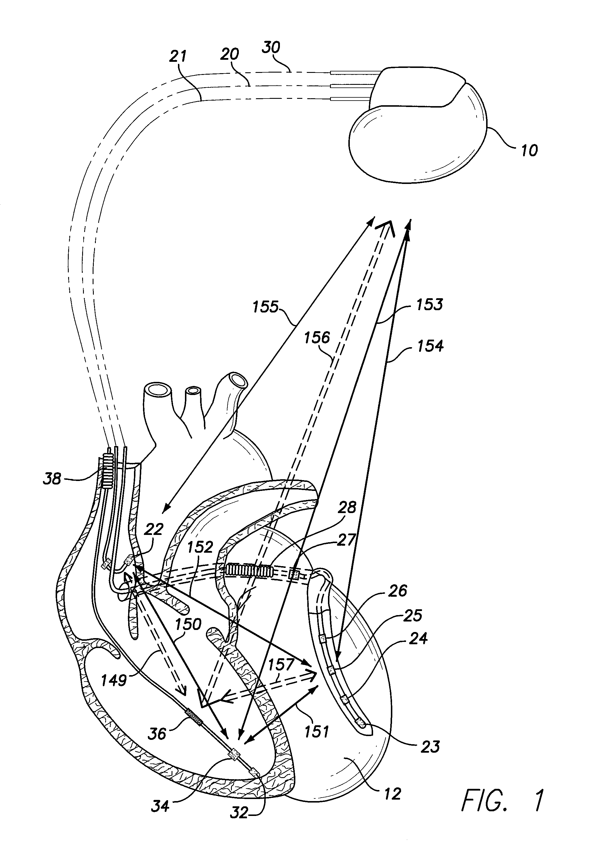 Method and system to correct contractility based on non-heart failure factors