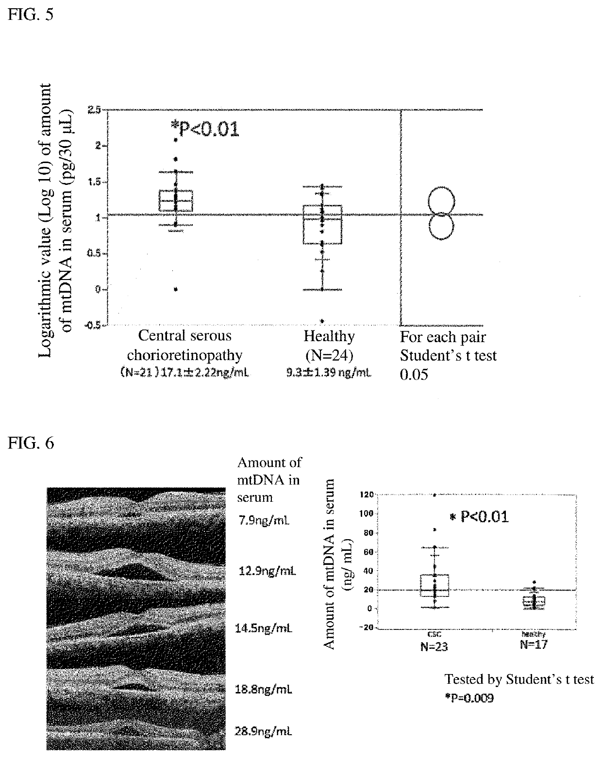 Eye disease biomarker