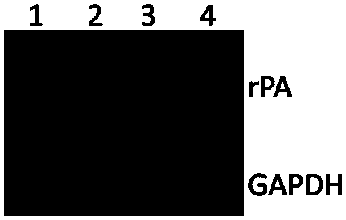 Cell strain and method of expressing reteplase (rPA) by human source cells