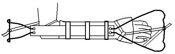 Forearm traction splint