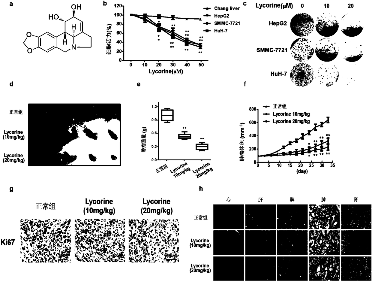 Application of Akt inhibitor to preparation of medicament for enhancing anti-hepatoma activity of lycorine