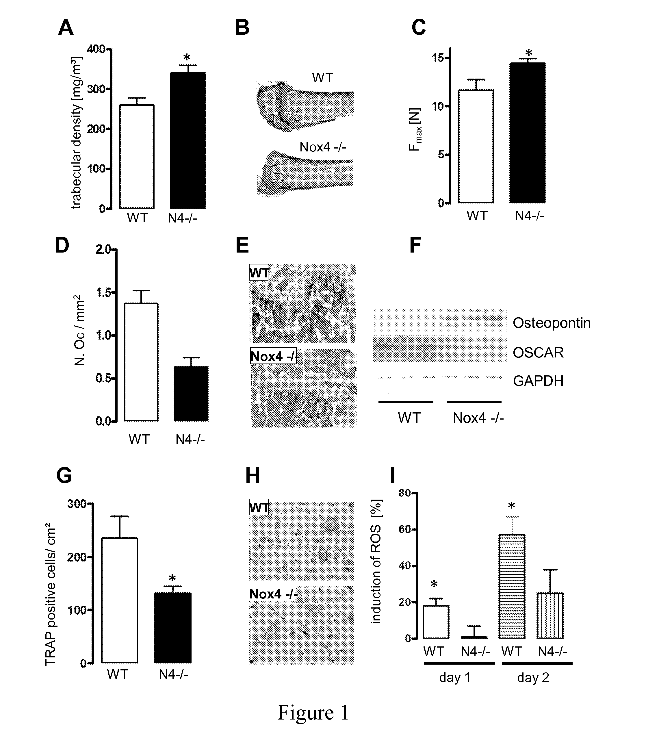Nadph oxidase 4 inhibitors and use thereof