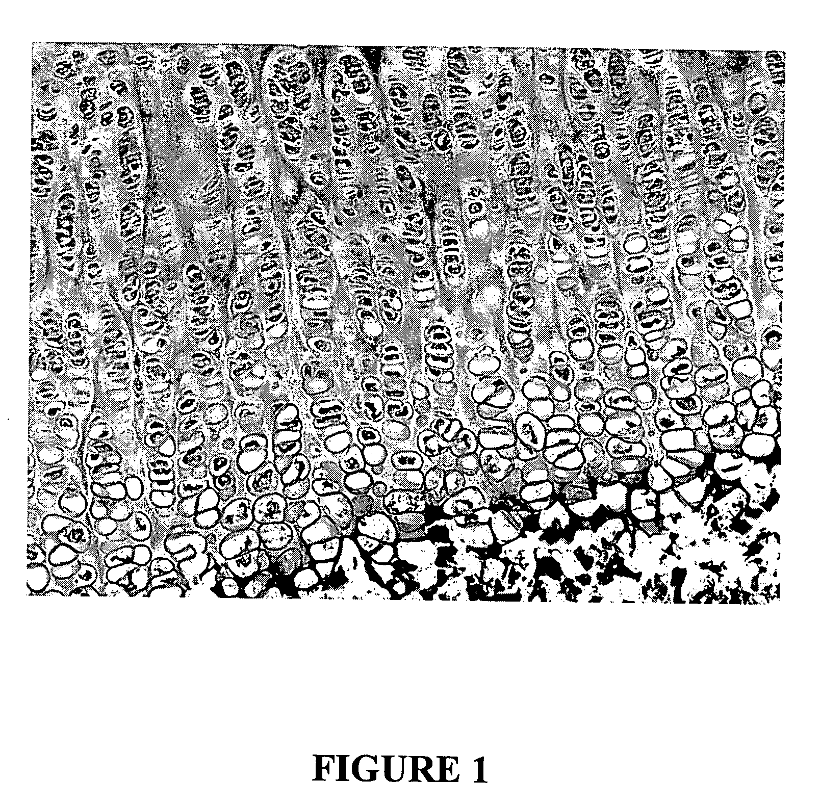 Method for remodeling bone and related sutures
