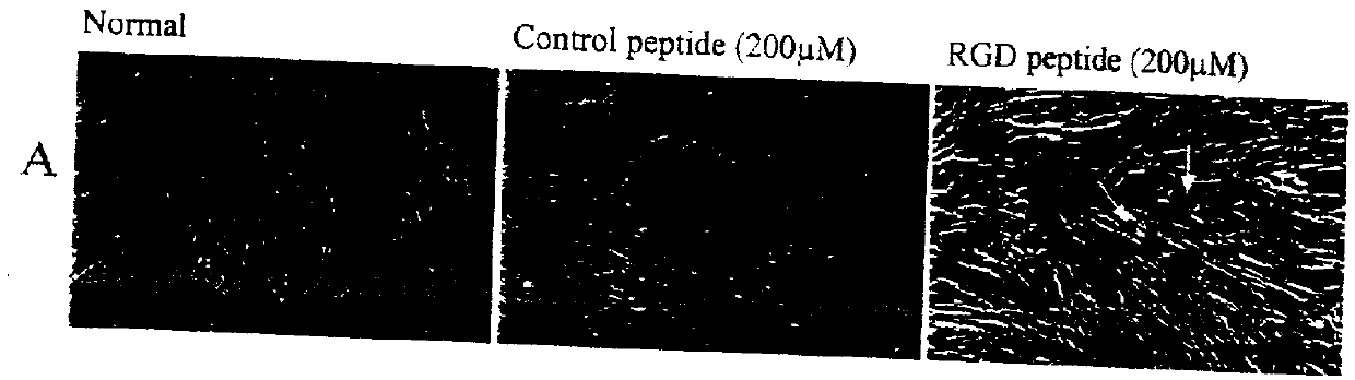 Method of treating disorders of the eye