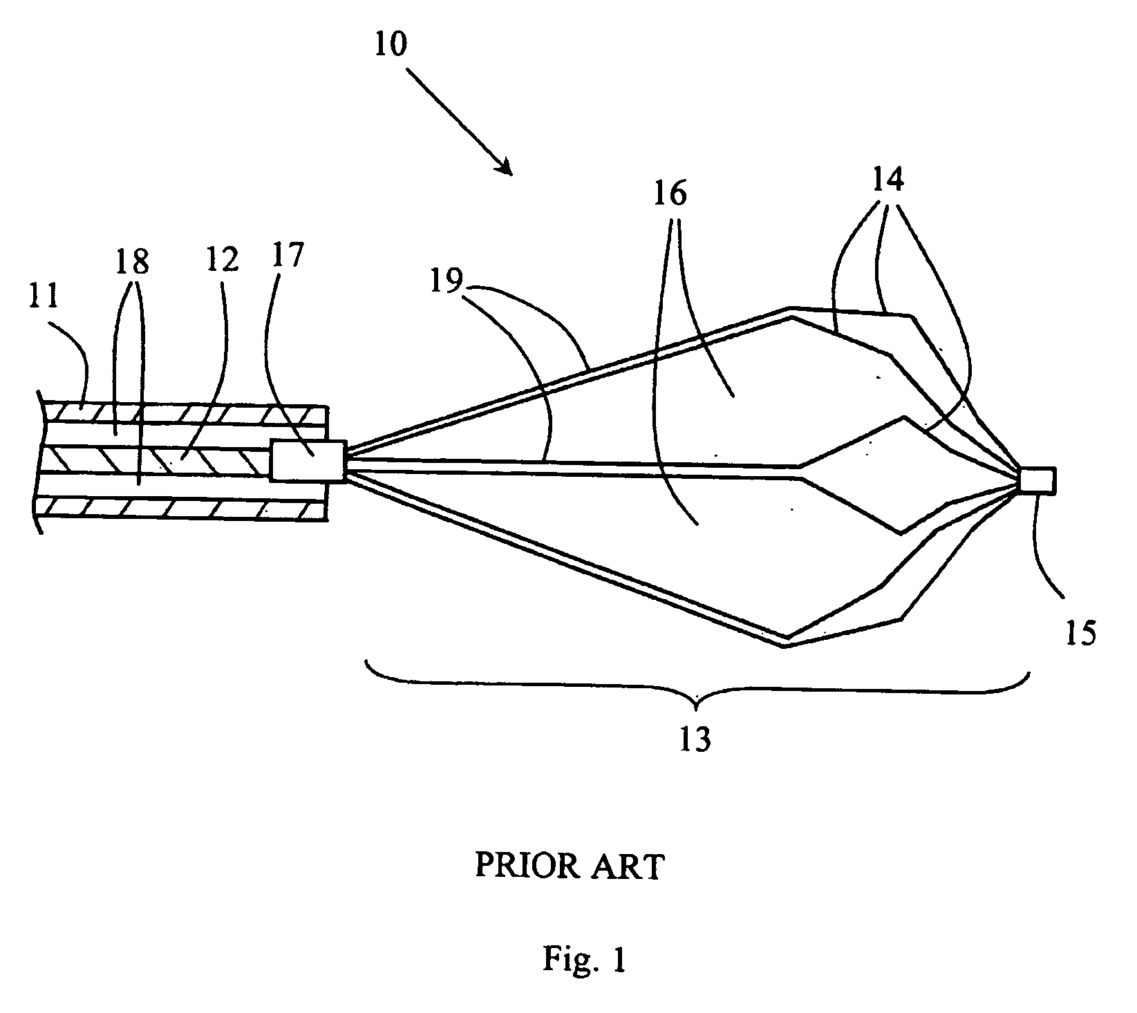 Method for manufacturing a surgical device for extracting a foreign object