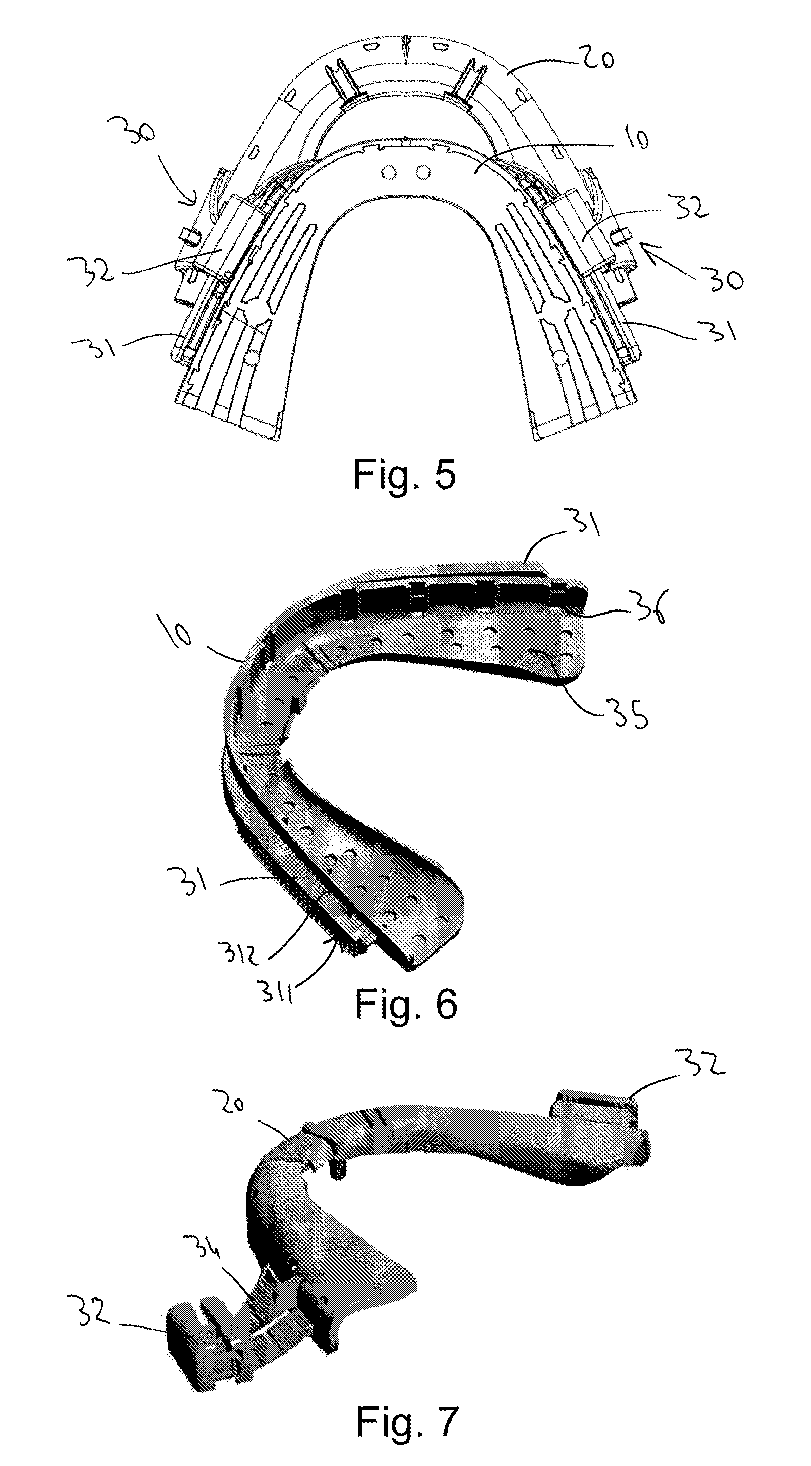 Intraoral orthosis, a method of fabricating such an orthosis, and a method of adjusting it