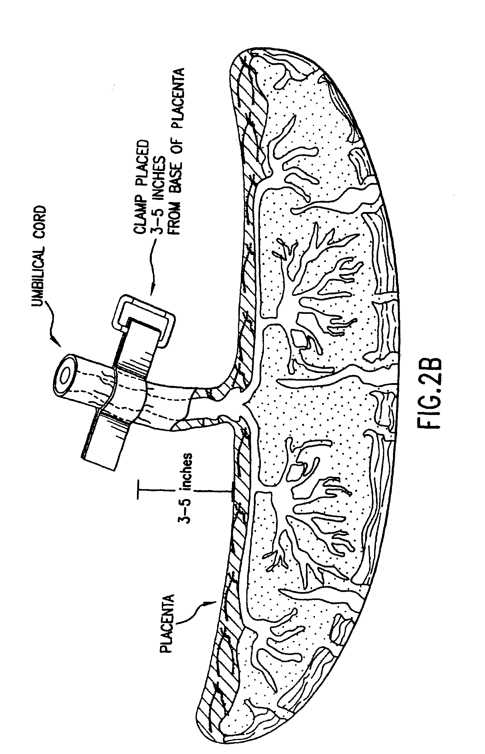 Composition for collecting and preserving placental stem cells and methods of using the composition