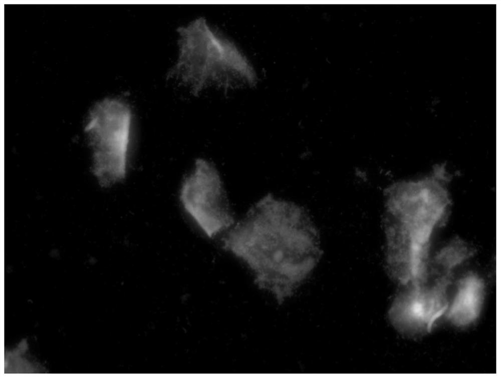 Multi-fluorescent staining solution as well as preparation method and use method thereof