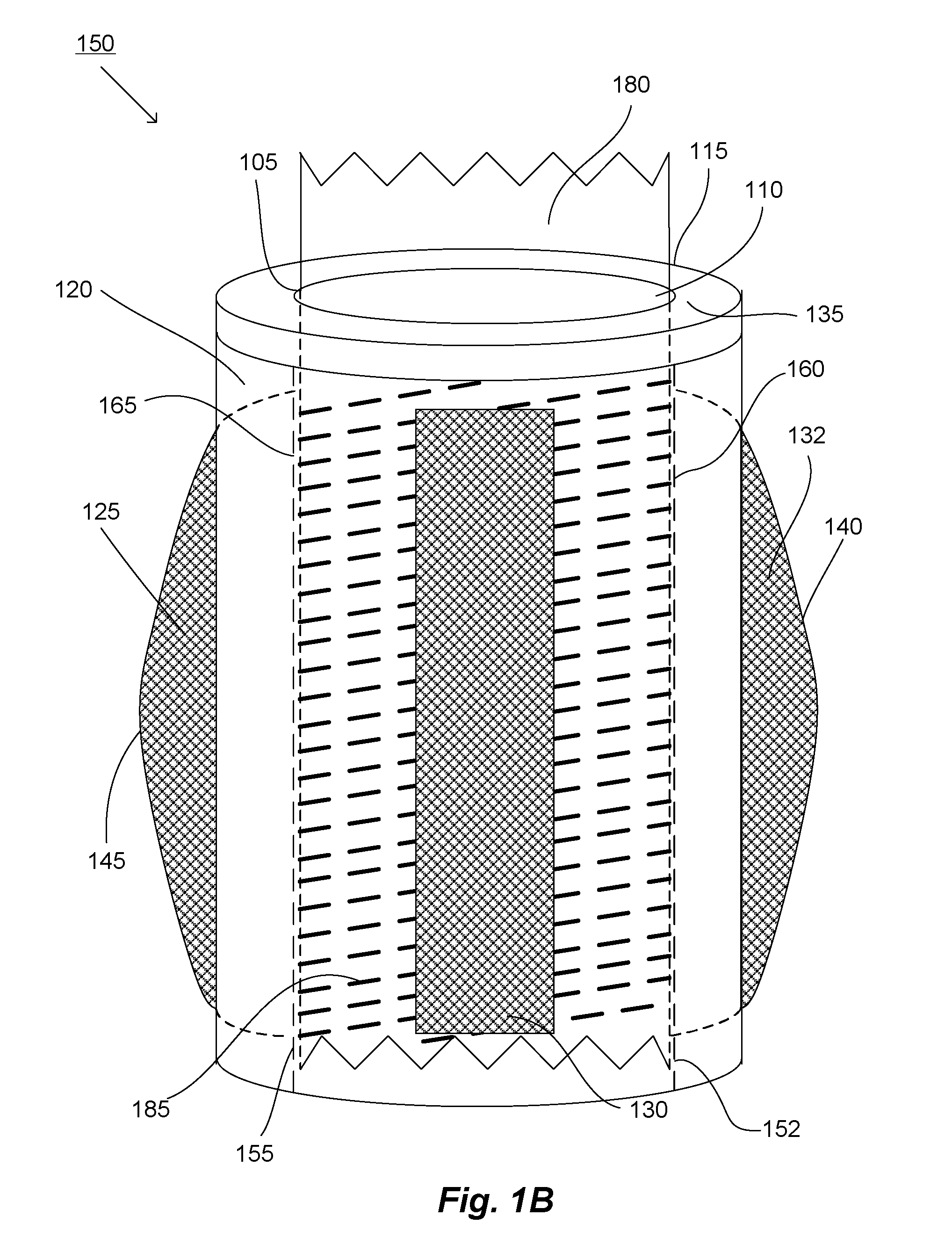 Systems and Methods for the Medical Treatment of Structural Tissue