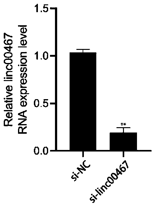 Application of linc00467 gene-targeted siRNA to leukemia medicine resistance