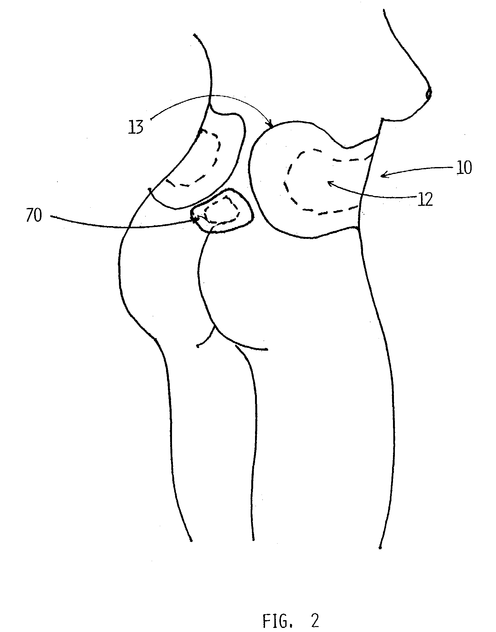 Anatomical compression pad system
