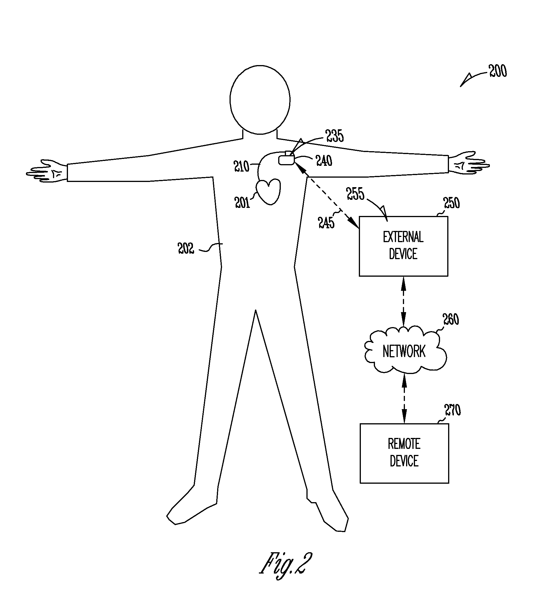 Dynamic device therapy control for treating post myocardial infarction patients