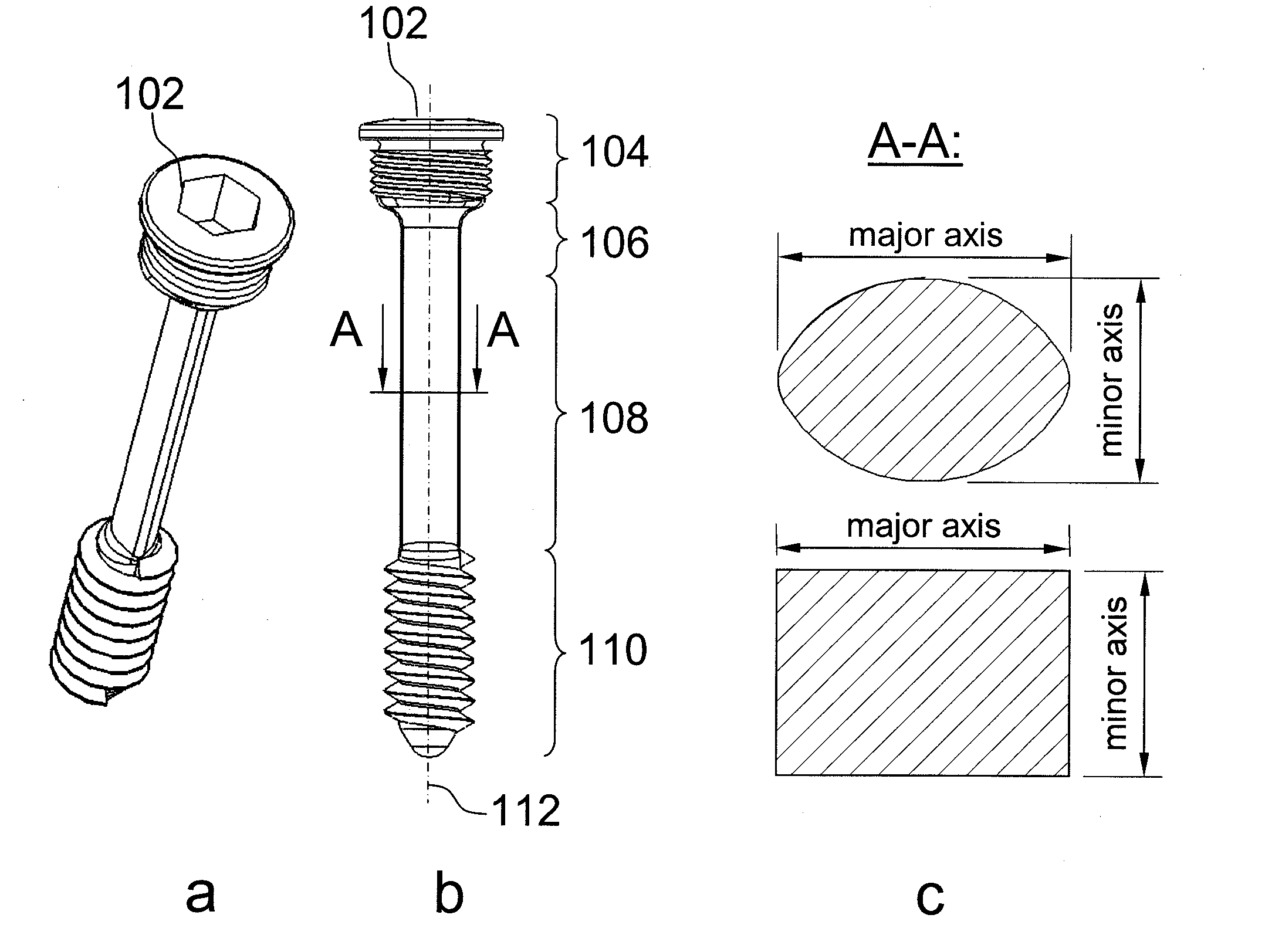 Rotationally asymmetric bone screw