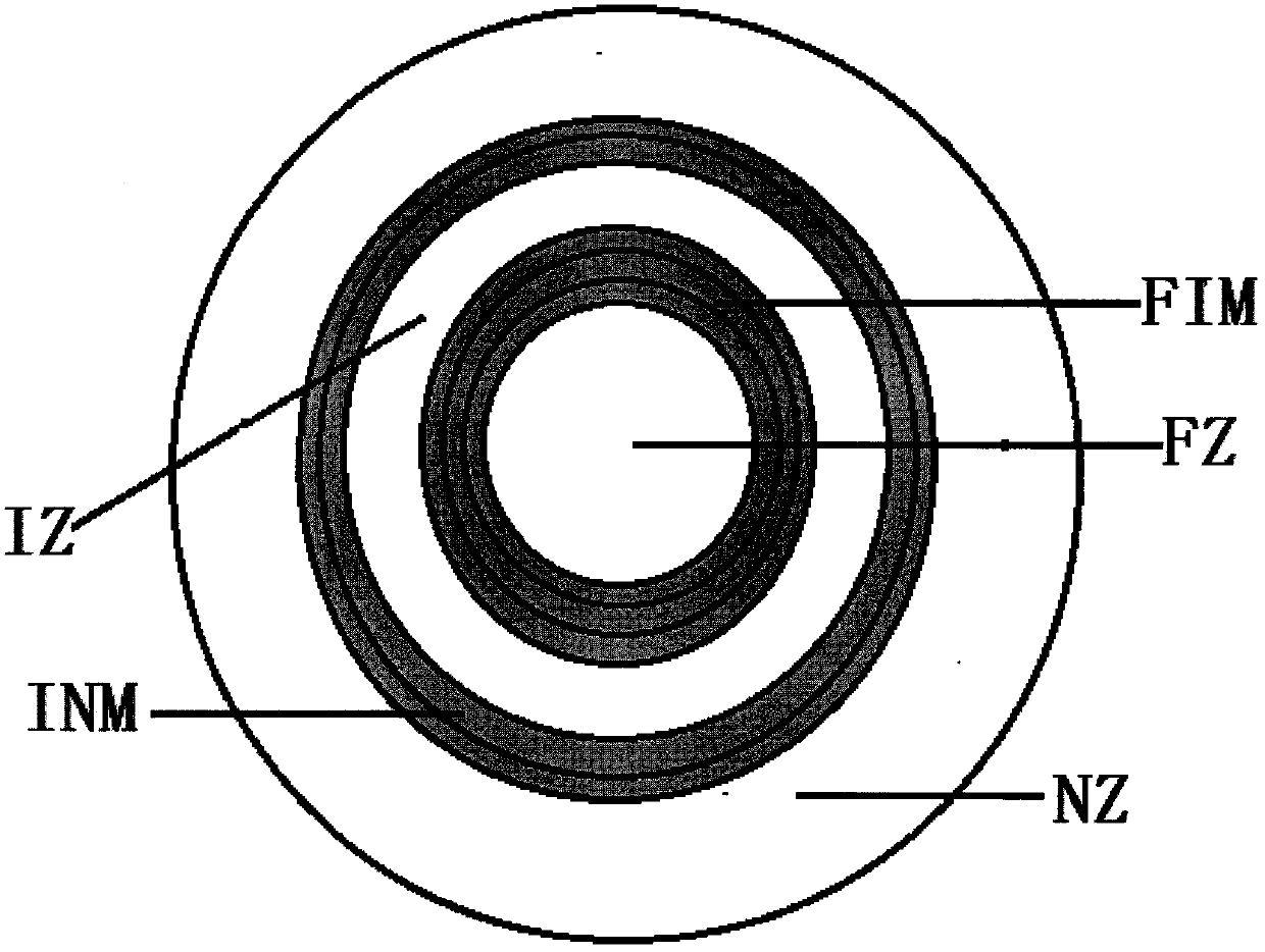 Annular trifocus and bifocus spectacle lens