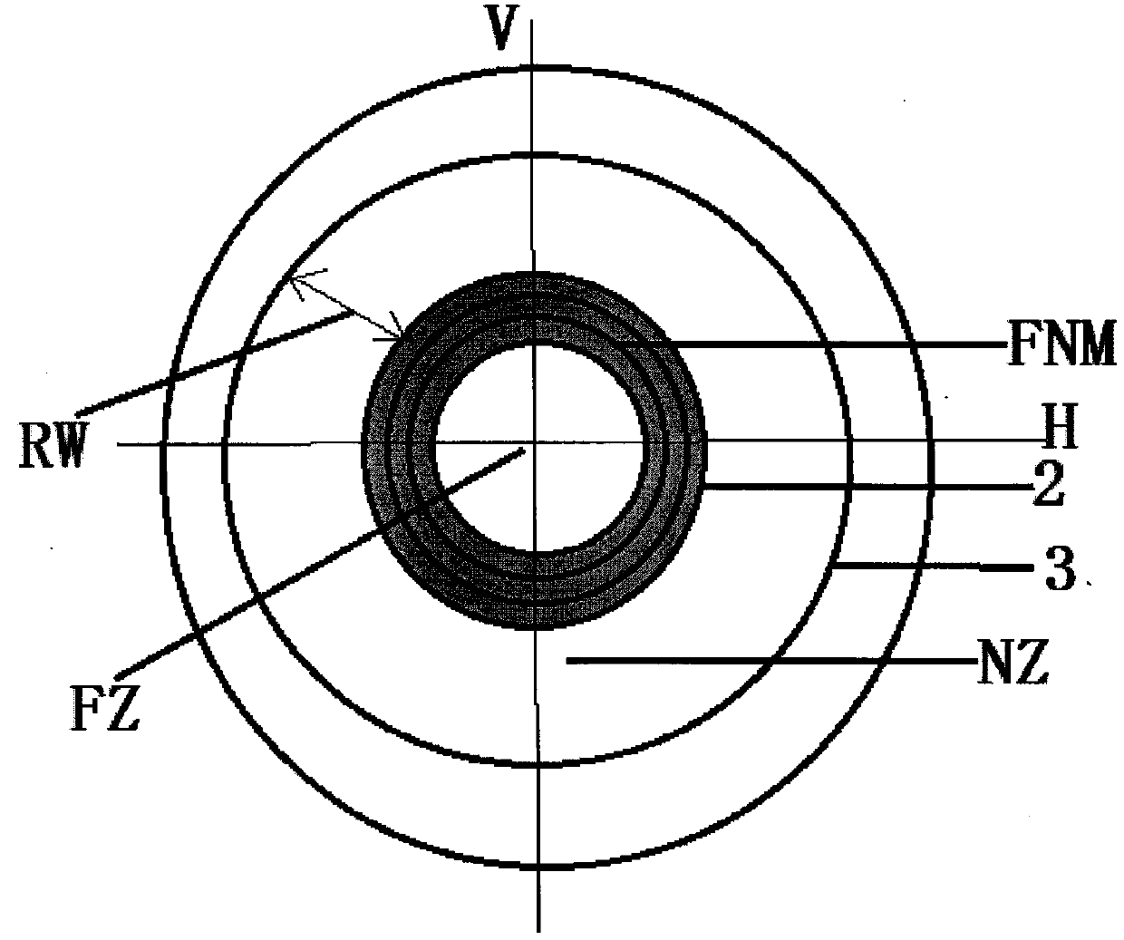 Annular trifocus and bifocus spectacle lens